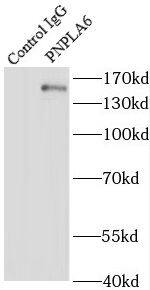 Immunoprecipitation: PNPLA6 Antibody - BSA Free [NBP3-47100] - IP result of anti-PNPLA6 ( PNPLA6