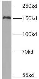 Western Blot: PNPLA6 Antibody - BSA Free [NBP3-47100] - Mouse brain tissue were subjected to SDS PAGE followed by western blot with (PNPLA6 antibody) at dilution of 1:500