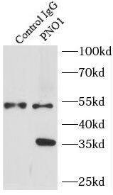 Immunoprecipitation: PNO1 Antibody - BSA Free [NBP3-47101] - IP Result of anti-PNO1 (IP:, 3ug; Detection:2 1:300) with L02 cells lysate 1500ug.