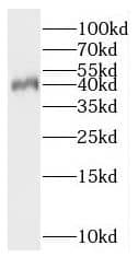 Western Blot: PNMA2 Antibody - BSA Free [NBP3-47103] - Jurkat cells were subjected to SDS PAGE followed by western blot with (PNMA2 antibody) at dilution of 1:2000
