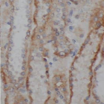 Immunohistochemistry: PNLDC1 Antibody - BSA Free [NBP3-47104] - Immunohistochemistry of paraffin-embedded human testis tissue slide using (PNLDC1 Antibody) at dilution of 1:50