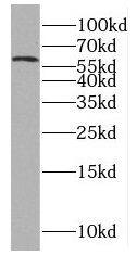Western Blot: PNLDC1 Antibody - BSA Free [NBP3-47104] - Raji cells were subjected to SDS PAGE followed by western blot with (PNLDC1 Antibody) at dilution of 1:600