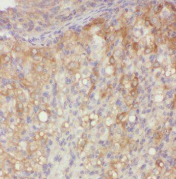 Immunohistochemistry PNCK Antibody - BSA Free