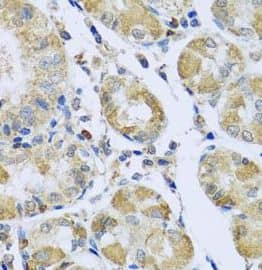 Immunohistochemistry: Mitochondrial-processing peptidase subunit beta Antibody - BSA Free [NBP3-47106] - Immunohistochemistry of paraffin-embedded human stomach using (Mitochondrial-processing peptidase subunit beta antibody) at dilution of 1:100