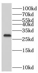 Western Blot: PMM1/Phosphomannomutase 1 Antibody - BSA Free [NBP3-47107] - Mouse brain tissue were subjected to SDS PAGE followed by western blot with (PMM1/Phosphomannomutase 1 antibody) at dilution of 1:600