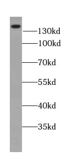 Western Blot: PMCA2 Antibody - BSA Free [NBP3-47108] - Human brain tissue were subjected to SDS PAGE followed by western blot with (PMCA2 antibody) at dilution of 1:500