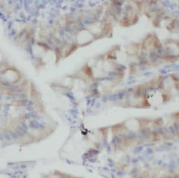 Immunohistochemistry PLS1 Antibody - BSA Free