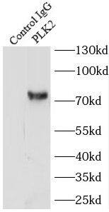 Immunoprecipitation: PLK2 Antibody - BSA Free [NBP3-47114] - IP Result of anti-PLK2 (IP:, 4ug; Detection: 1:300) with HeLa cells lysate 2480ug.