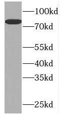 Western Blot: PLK2 Antibody - BSA Free [NBP3-47114] - HeLa cells were subjected to SDS PAGE followed by western blot with (PLK2 antibody) at dilution of 1:2000