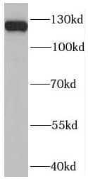 Western Blot: PLEKHH2 Antibody - BSA Free [NBP3-47116] - Jurkat cells were subjected to SDS PAGE followed by western blot with ( PLEKHH2 Antibody) at dilution of 1:300