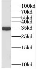 Western Blot: PLEKHA3 Antibody - BSA Free [NBP3-47121] - COLO 320 cells were subjected to SDS PAGE followed by western blot with (PLEKHA3 antibody) at dilution of 1:200