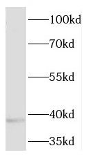 Western Blot: Pleckstrin-2 Antibody - BSA Free [NBP3-47122] - PC-3 cells were subjected to SDS PAGE followed by western blot with (Pleckstrin-2 antibody) at dilution of 1:500