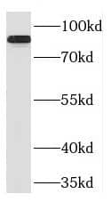 Western Blot: Phospholipase C delta 1 Antibody - BSA Free [NBP3-47124] - Human rectum tissue were subjected to SDS PAGE followed by western blot with P(Phospholipase C delta 1 antibody) at dilution of 1:400