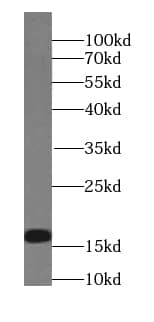 Western Blot: Plasmolipin Antibody - BSA Free [NBP3-47125] - Human testis tissue were subjected to SDS PAGE followed by western blot with (Plasmolipin antibody) at dilution of 1:1000