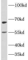 Western Blot: PLAGL2 Antibody - BSA Free [NBP3-47127] - Raji cells were subjected to SDS PAGE followed by western blot with (PLAGL2 antibody) at dilution of 1:500