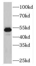 Western Blot: PLAGL1 Antibody - BSA Free [NBP3-47128] - MCF-7 cells were subjected to SDS PAGE followed by western blot with ( PLAGL1 Antibody) at dilution of 1:600
