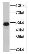 Western Blot: PLAG1 Antibody - BSA Free [NBP3-47129] - A431 cells were subjected to SDS PAGE followed by western blot with ( PLAG1 Antibody) at dilution of 1:300