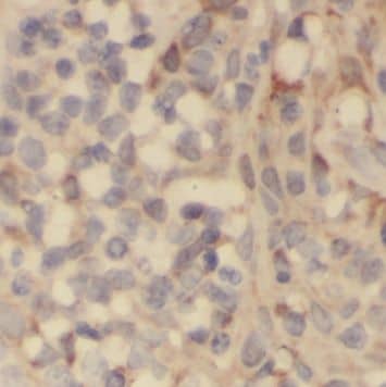 Immunohistochemistry: PLAC8 Antibody - BSA Free [NBP3-47130] - Immunohistochemistry of paraffin-embedded human tonsils tissue using (PLAC8 antibody) at dilution of 1:50