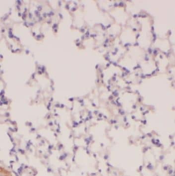 Immunohistochemistry: PLA2G4F Antibody - BSA Free [NBP3-47131] - Immunohistochemistry of paraffin-embedded human lung using (PLA2G4F antibody) at dilution of 1:200