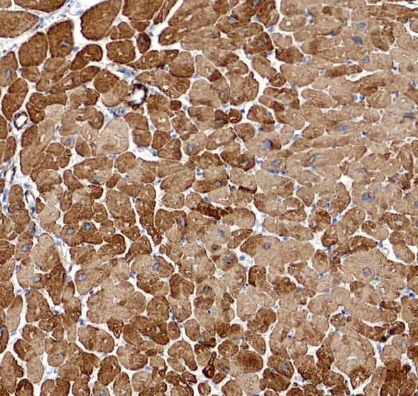 Immunohistochemistry: PLA2G4E Antibody - BSA Free [NBP3-47132] - Immunohistochemistry of paraffin-embedded human skeletal muscle using (PLA2G4E antibody) at dilution of 1:50