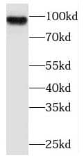 Western Blot: PLA2G4E Antibody - BSA Free [NBP3-47132] - SH-SY5Y cells were subjected to SDS PAGE followed by western blot with (PLA2G4E antibody) at dilution of 1:1000