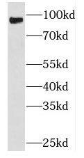Western Blot: PLA2G4D Antibody - BSA Free [NBP3-47133] - Mouse brain tissue were subjected to SDS PAGE followed by western blot with (PLA2G4D antibody) at dilution of 1:500