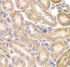 Immunohistochemistry: PIP5K2 alpha Antibody - BSA Free [NBP3-47141] - Immunohistochemistry of paraffin-embedded rat kidney using (PIP5K2 alpha antibody) at dilution of 1:50