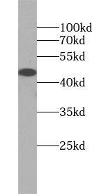 Western Blot PIP5K2 alpha Antibody - BSA Free