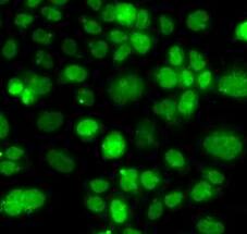 Immunocytochemistry/ Immunofluorescence: PIP5K2 alpha Antibody - BSA Free [NBP3-47141] - Immunofluorescence analysis of A549 cells using PIP5K2 alpha antibody ()