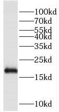 Western Blot: PIK3C2G Antibody - BSA Free [NBP3-47143] - A549 cells were subjected to SDS PAGE followed by western blot with (PIK3C2G Antibody) at dilution of 1:600