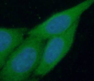 Immunocytochemistry/ Immunofluorescence PIGZ Antibody - BSA Free