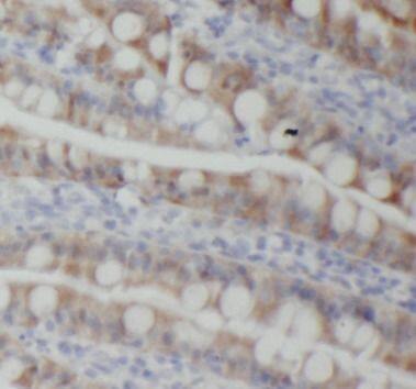 Immunohistochemistry PIGZ Antibody - BSA Free