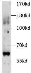 Western Blot PIGZ Antibody - BSA Free