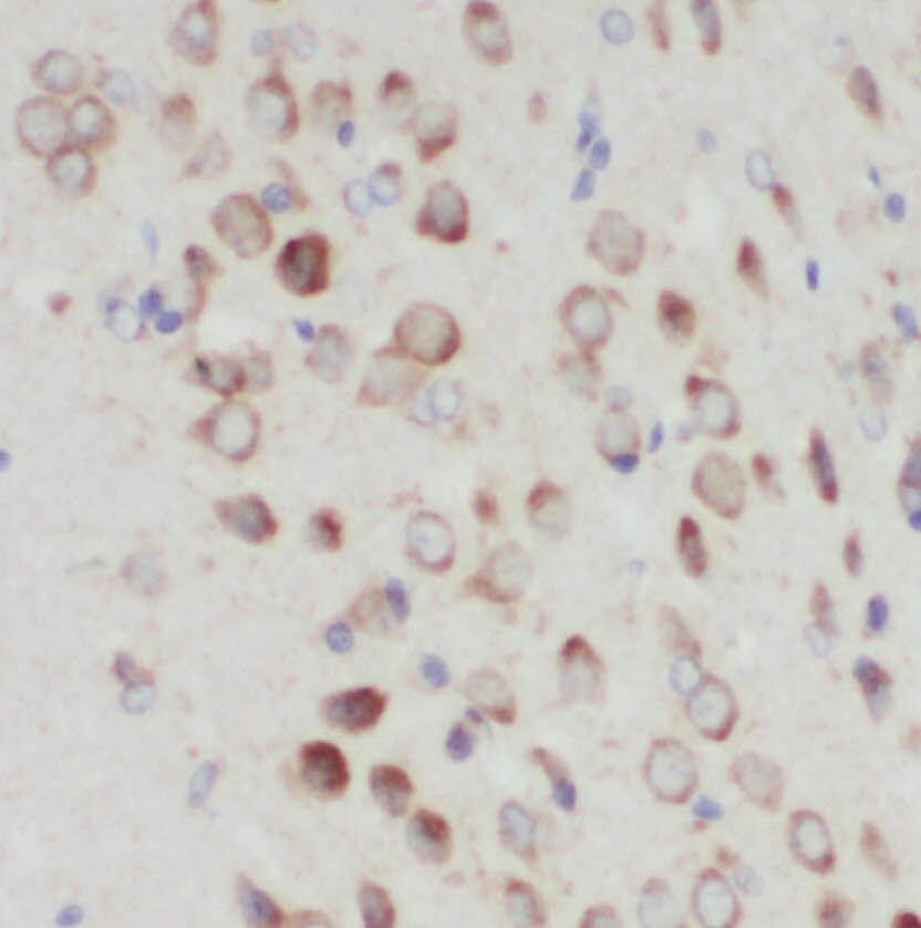Immunohistochemistry: PIGT Antibody - BSA Free [NBP3-47145] - Immunohistochemistry of paraffin-embedded human brain using (PIGT antibody) at dilution of 1:100