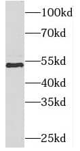 Western Blot PIGB Antibody - BSA Free
