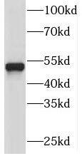 Western Blot: PI4K2A Antibody - BSA Free [NBP3-47152] - HepG2 cells were subjected to SDS PAGE followed by western blot with (PI4K2A antibody) at dilution of 1:800