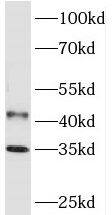 Western Blot: PHYHIP Antibody - BSA Free [NBP3-47154] - Mouse brain tissue were subjected to SDS PAGE followed by western blot with (PHYHIP antibody) at dilution of 1:1000