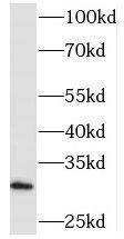 Western Blot: PHYHD1 Antibody - BSA Free [NBP3-47155] - Human liver tissue were subjected to SDS PAGE followed by western blot with (PHYHD1 antibody) at dilution of 1:800