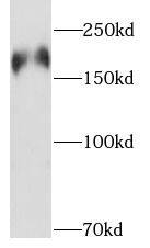 Western Blot: PHLPP Antibody - BSA Free [NBP3-47157] - Mouse brain tissue were subjected to SDS PAGE followed by western blot with (PHLPP antibody) at dilution of 1:1000