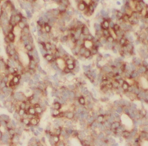 Immunohistochemistry PHLPP Antibody - BSA Free