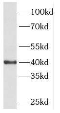 Western Blot: PHKG1 Antibody - BSA Free [NBP3-47159] - Mouse skeletal muscle tissue were subjected to SDS PAGE followed by western blot with (PHKG1 antibody) at dilution of 1:500