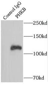 Immunoprecipitation Phosphorylase B Antibody - BSA Free