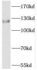 Western Blot Phosphorylase B Antibody - BSA Free