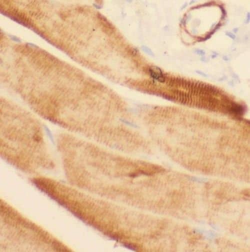 Immunohistochemistry Phosphorylase B Antibody - BSA Free