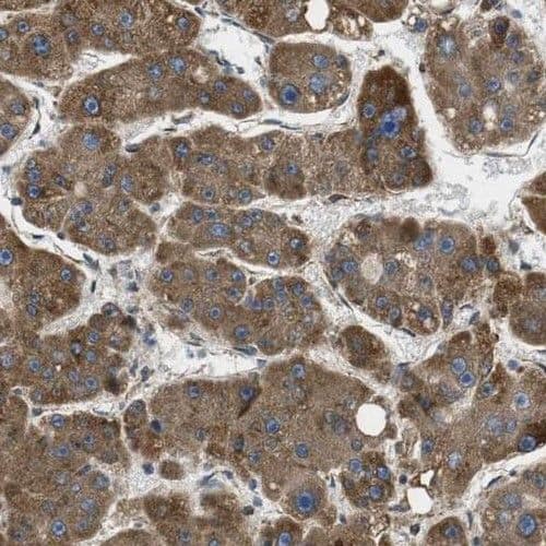 Immunohistochemistry PHKA2 Antibody - BSA Free