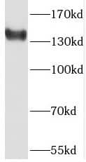 Western Blot PHKA2 Antibody - BSA Free