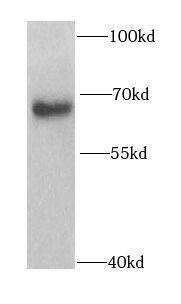 Western Blot: PHF19 Antibody - BSA Free [NBP3-47165] - Mouse brain tissue were subjected to SDS PAGE followed by western blot with (PHF19 antibody) at dilution of 1:1000