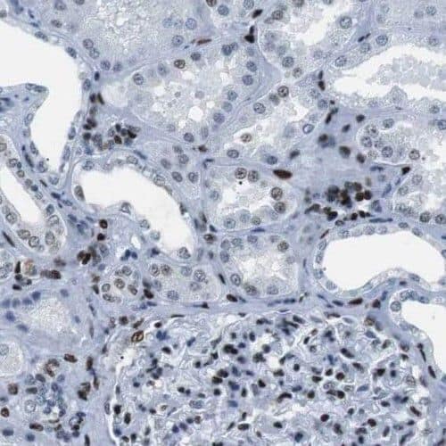 Immunohistochemistry PHF14 Antibody - BSA Free