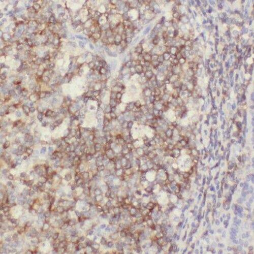 Immunohistochemistry PGPase Antibody - BSA Free