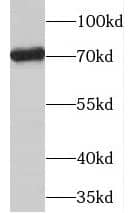 Western Blot PGM2L1 Antibody - BSA Free
